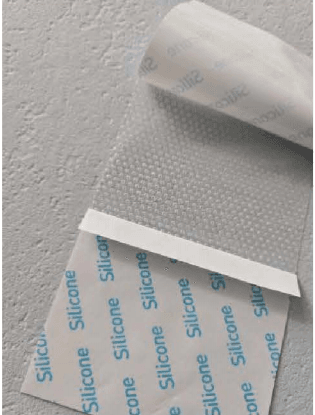 Nonwoven Roll