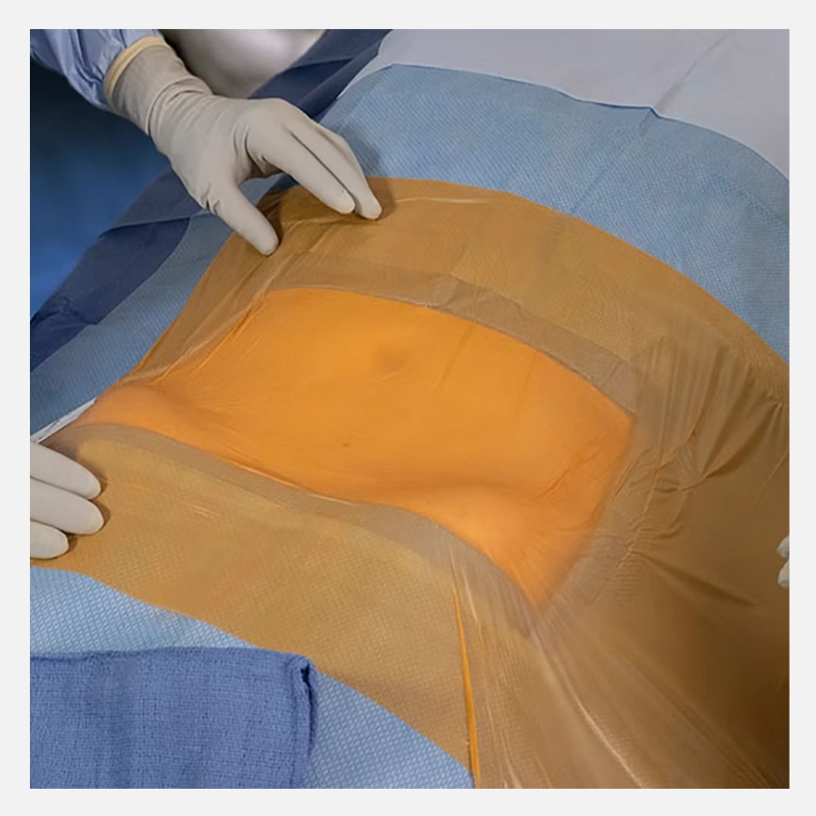 Surgical Incise Film